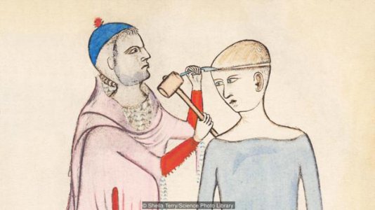 trepanning.jpg